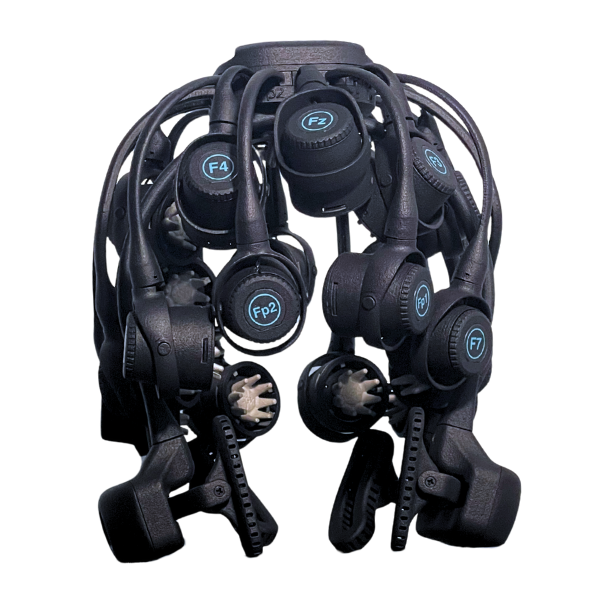 A Image of the Octopus Technology